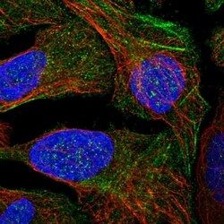 LYSMD4 Antibody, Novus Biologicals 25 &mu;L | Buy Online | Novus Biologicals | Fisher Scientific